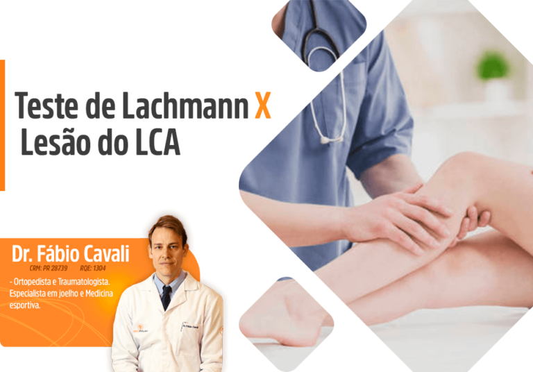 Teste de Lachman x Lesão do LCA